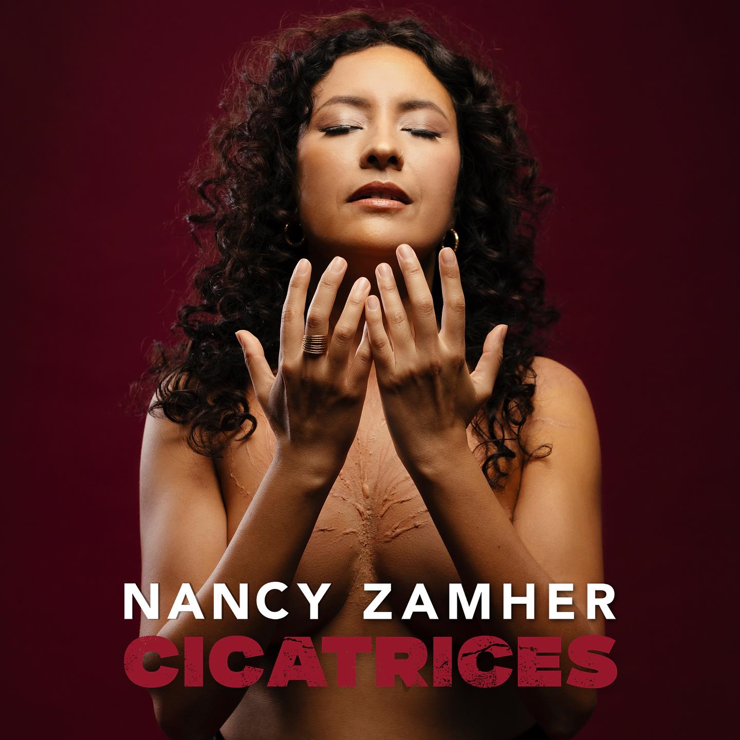 Nancy zamher cicatrices